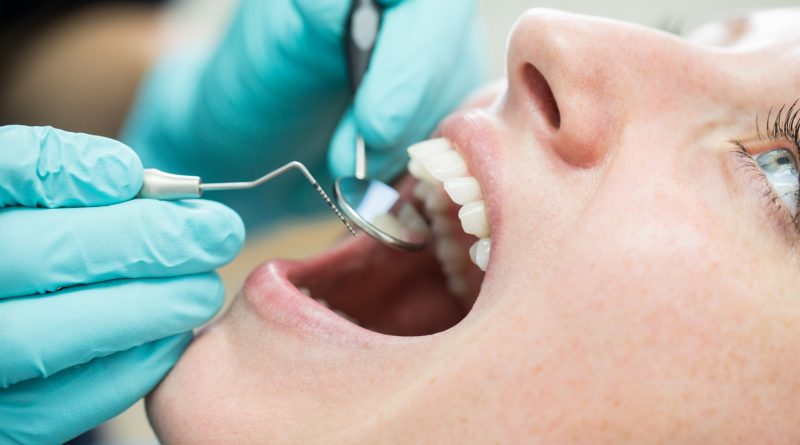 Why you might need a California dental malpractice lawyer